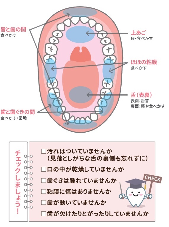 汚れやすい部位・汚れの種類