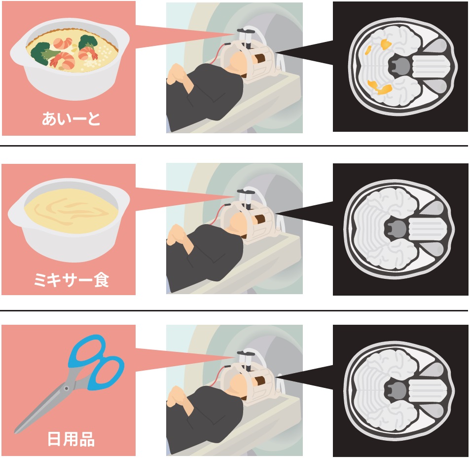 あいーとの見た目が脳活動を高め3