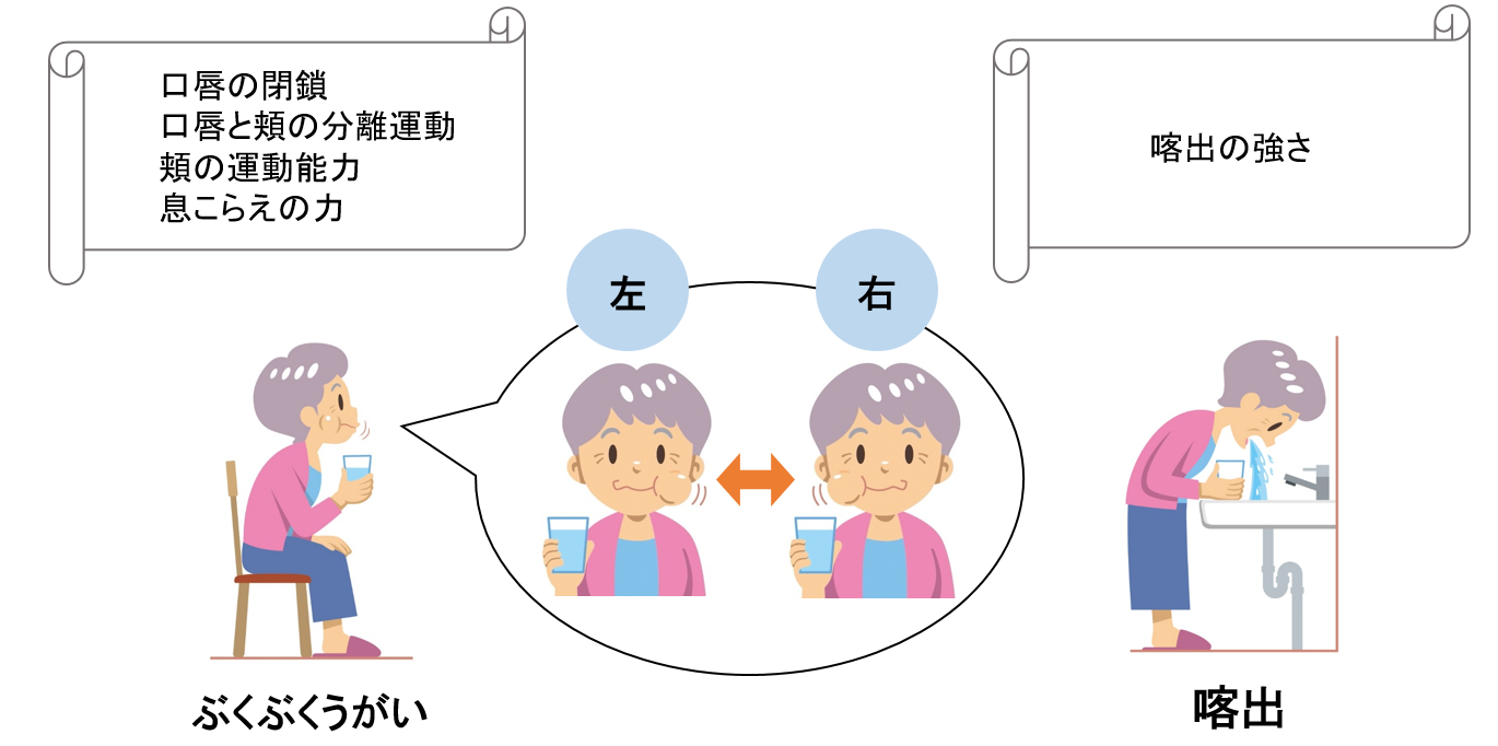 図2.「ぶくぶくうがい」と「喀出」のチェックポイント